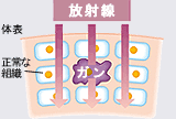 放射線