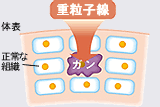 重粒子線