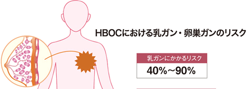 HBOCにおける乳ガン・卵巣ガンのリスク